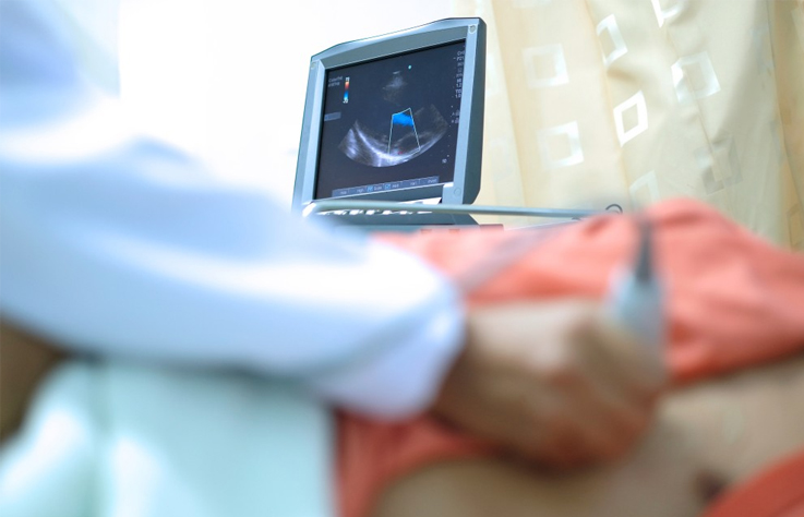ecocardiograma1