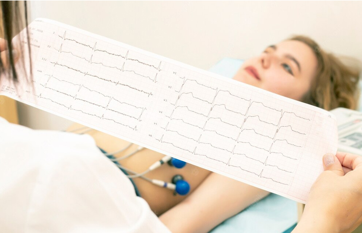 electrocardiograma-1
